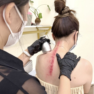 【艾拉美學】艾草溫罐40min