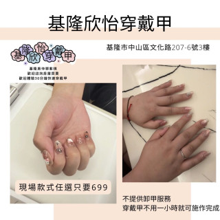 【基隆穿戴甲】基隆欣怡穿戴甲