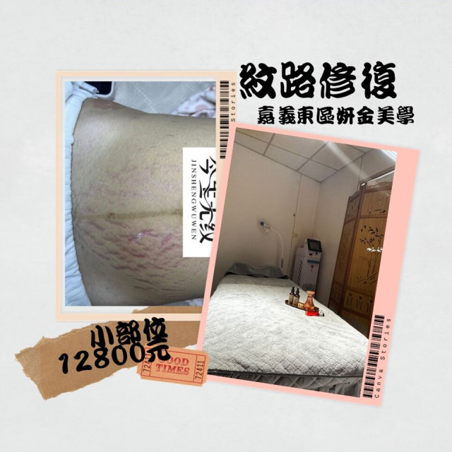 【嘉義妍金美學】紋路保養修復體驗（小部位）