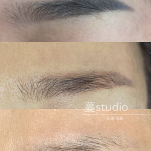 【蔓】無創除色訂金