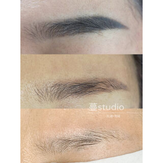 【蔓】無創除色訂金