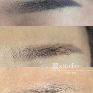 【蔓】無創除色訂金