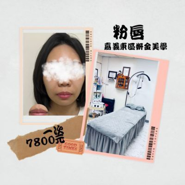 【嘉義妍金美學】粉嫩唇色調整體驗